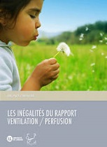 Couverture de l'iBook Les inégalités du rapport ventilation perfusion